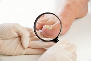 Plantar Warts Can Be Treated!