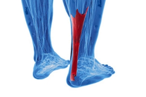 What You Need to Know About Achilles Tendon Injuries