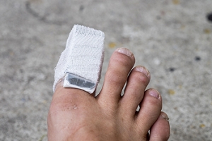 The Four Types of Athlete&#039;s Foot