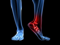 Elevating the Feet May Help Nighttime Ankle Pain