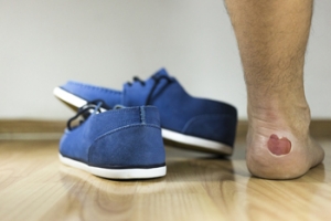 Why Is My Ankle in Pain?