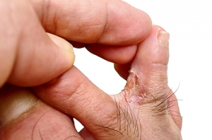 Can Foot Exercises Help My Feet?